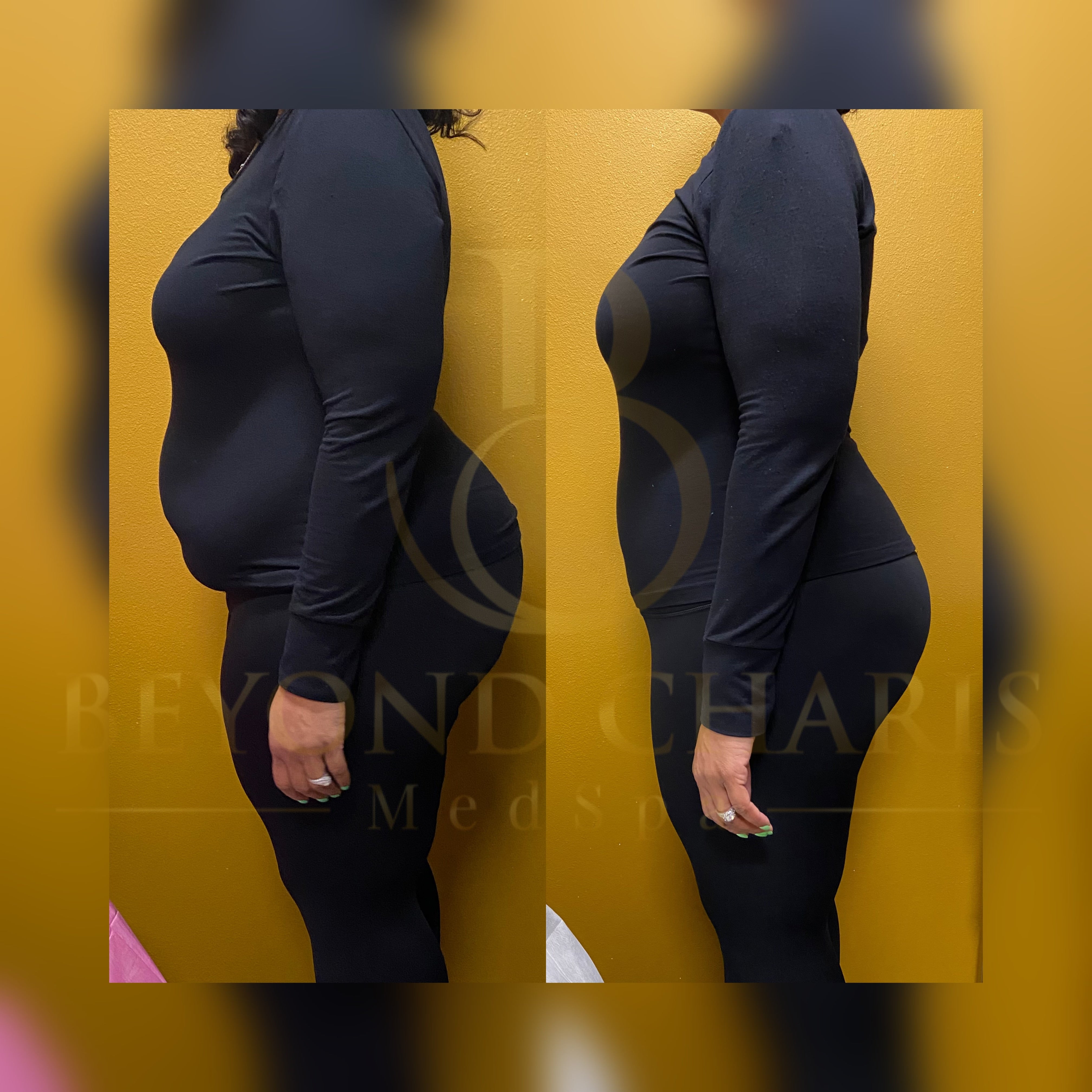 Client before and after