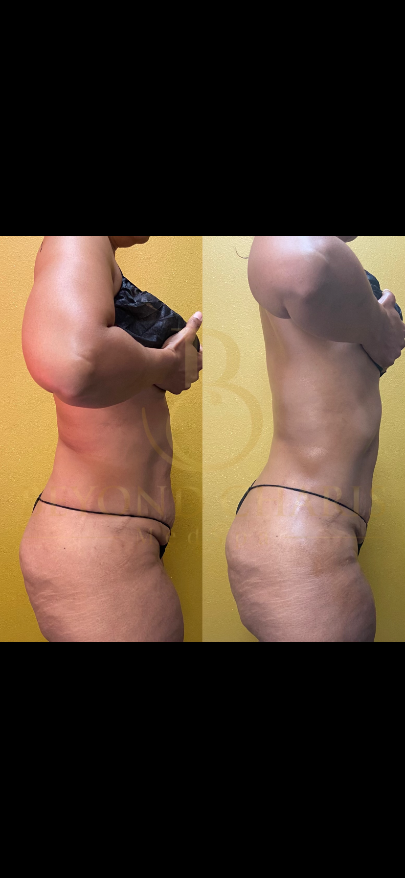 Client before and after